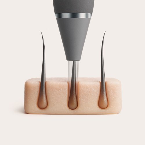  <span class="lte-header lte-h6"> Punch incision around<br />
hair follicles </span> 