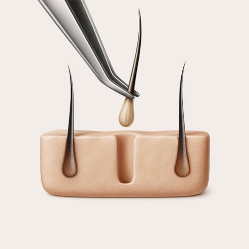  <span class="lte-header lte-h6"> Extraction hair of<br />
follicular units </span> 